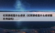 红斑狼疮是什么症状（红斑狼疮是什么症状图片传染吗）