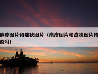 疱疹图片和症状图片（疱疹图片和症状图片传染吗）