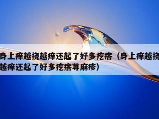 身上痒越挠越痒还起了好多疙瘩（身上痒越挠越痒还起了好多疙瘩荨麻疹）