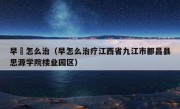 早玴怎么治（早怎么治疗江西省九江市都昌县思源学院楼业园区）