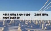 如何分辨黑色素瘤和普通痣？（怎样区别黑色素瘤和普通黑痣）