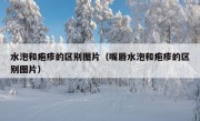 水泡和疱疹的区别图片（嘴唇水泡和疱疹的区别图片）